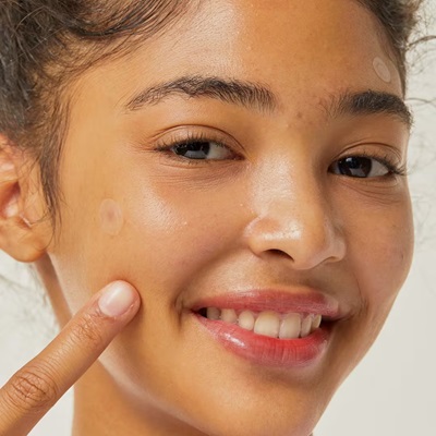 A woman's face close up; she is pointing to a clear pimple patch on her cheek